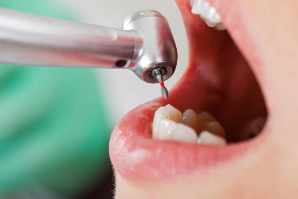 Reliable MS Emergency Dentist Solutions
